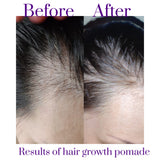 Herbal  Hair Grow Pomade